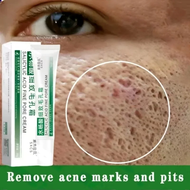 Korean Skincare Routine - Salicylic Acid Pore Clearing Cream Shrink