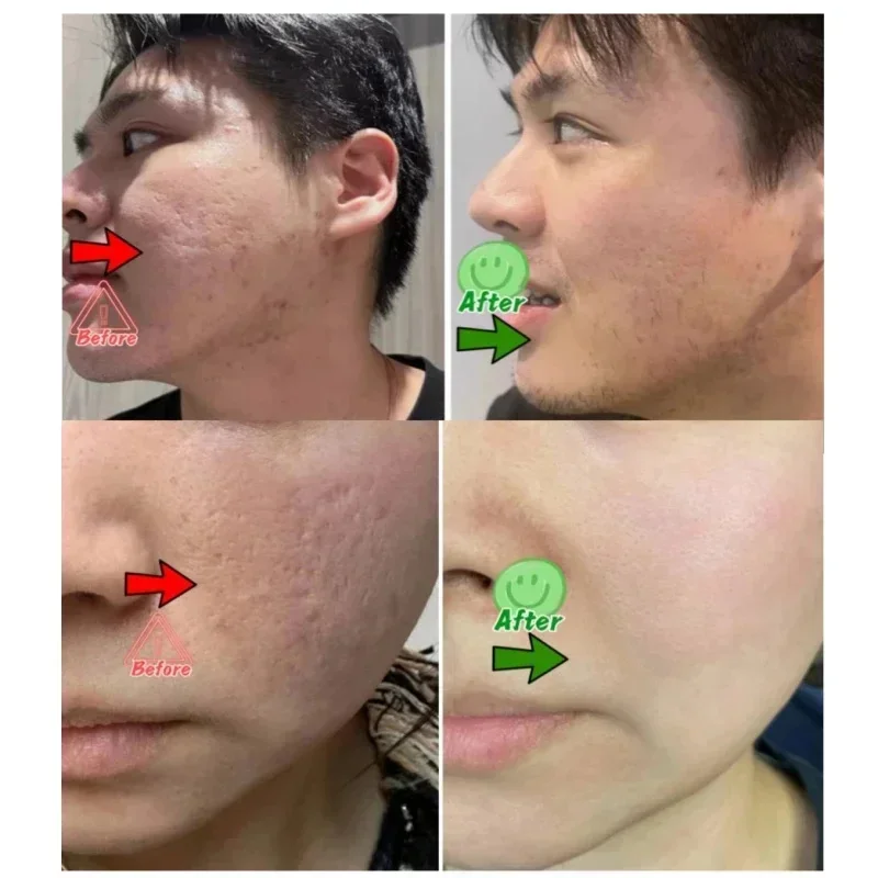 Salicylic Acid Pore Clearing C - Korean Skincare Routine 评论和价格