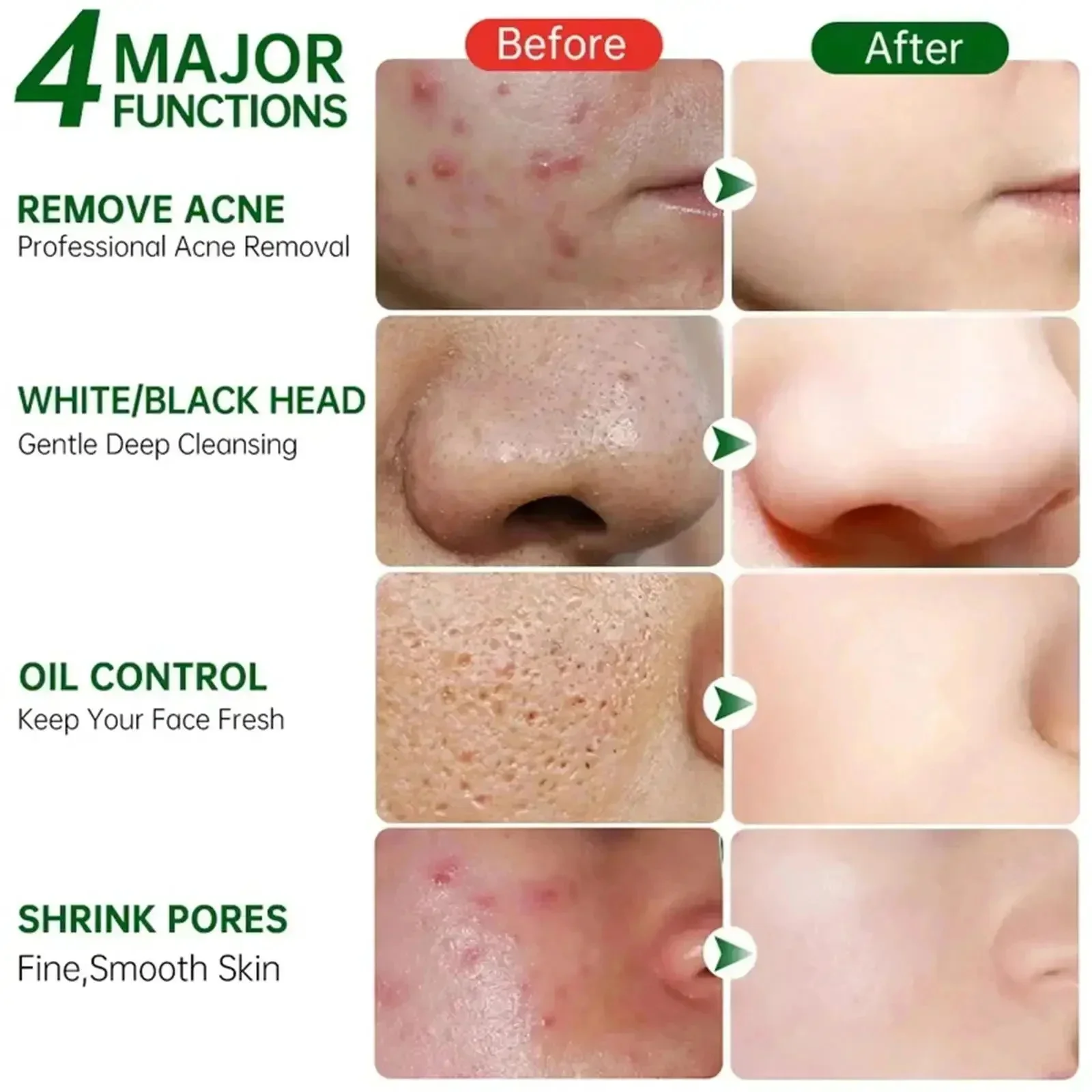 Salicylic Acid Pore Clearing C - Korean Skincare Routine 评论和价格