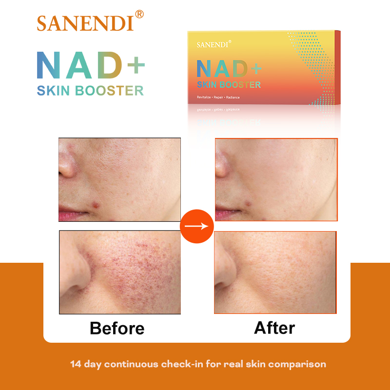 Sanendi NAD+ Korea Skincare Pr - Korean Skincare Routine 评论和价格